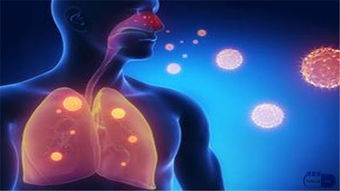 肺癌早期有什么症状出现肺结节会不会转成癌